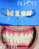 Slider image (6) Improve Dental